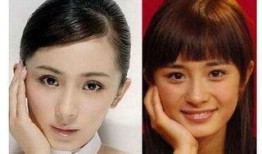 整容失败脸很鼓的网红吃瓜,美丽代价太大！